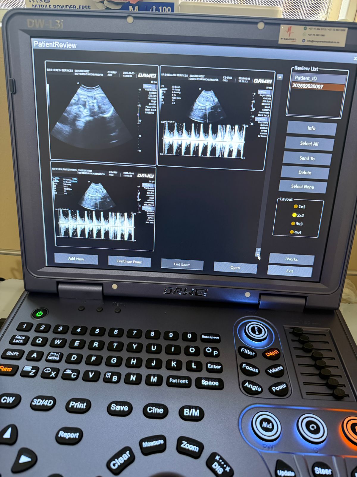 Sonar machine review screen showing ultrasound images with fetal heartbeat Doppler tracings